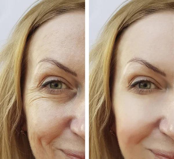 Collagen Boost® Colágeno + Ácido Hialurônico (Ativos do Botox)